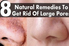 MORE NATURAL REMEDIES TO GET RID OF BLACKHEADS, PART II