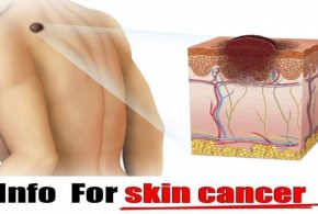 5 Symptoms That Tell You That You Have Skin Cancer